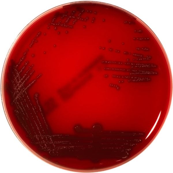 Trypticase™ Soy Agar II™