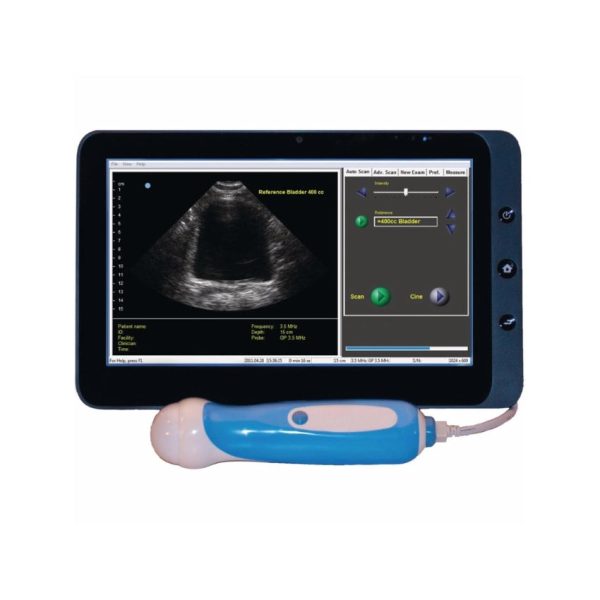 ViewBladder 10 Tablet Bladder Scanner