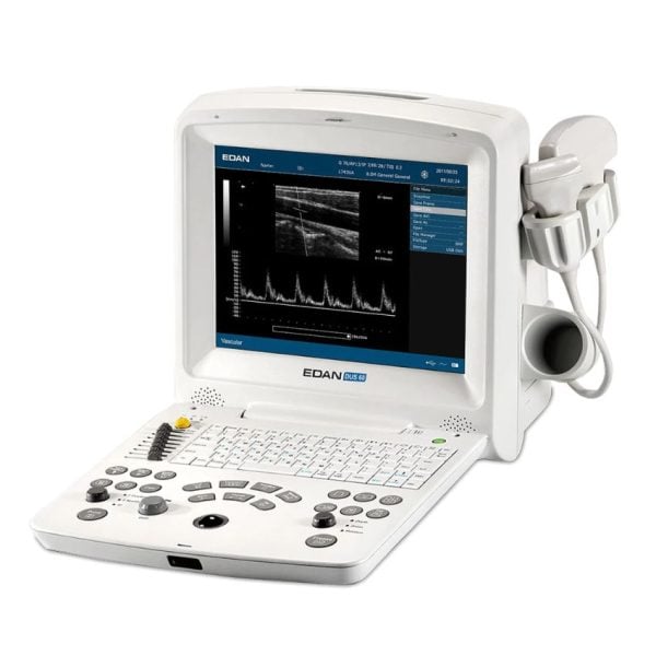 Digital Ultrasonic Diagnostic Imaging System