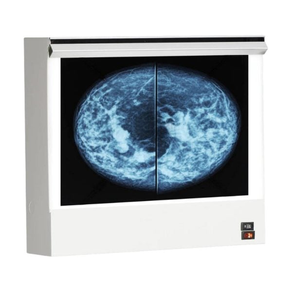 VuPlus Mammography Viewer