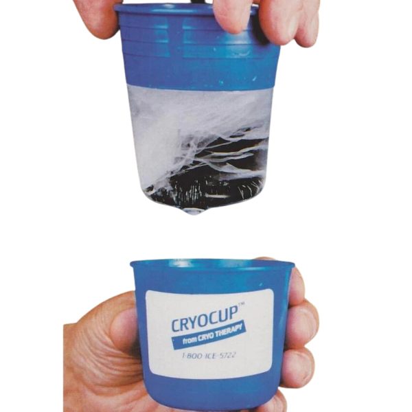 Cryo Therapy Cryocup