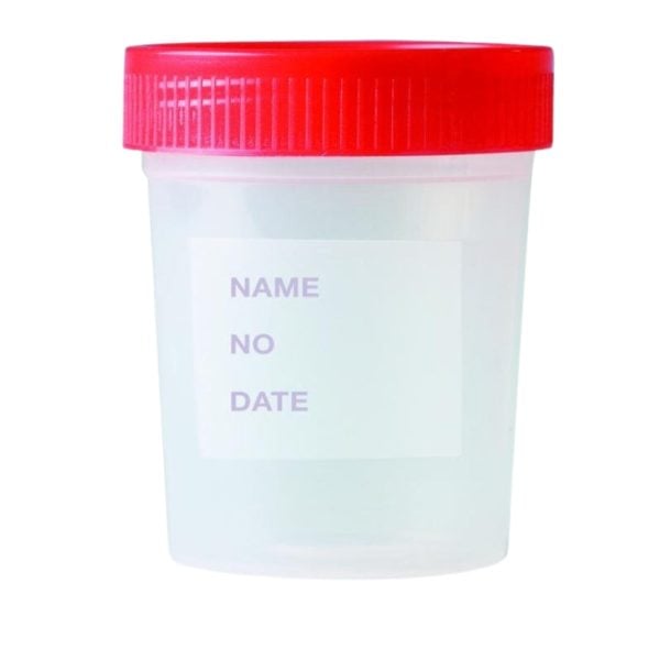 Sterile Urine Collection Container with Red Screw Cap 4 oz