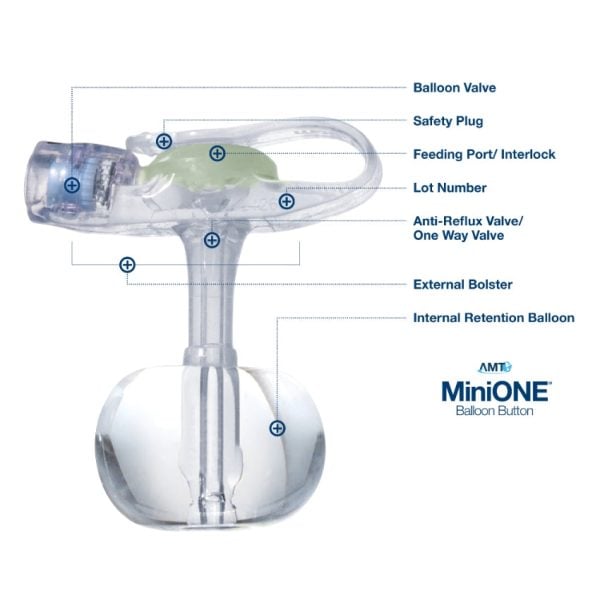 Balloon Button Gastrostomy Feeding Device Mini ONE 14 Fr. 1.2 cm Silicone Sterile - Image 2