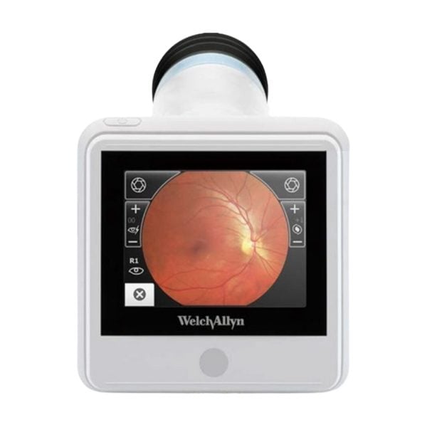 RetinaVue 100 Imager Non-Mydriatic Retinal Camera - Image 2