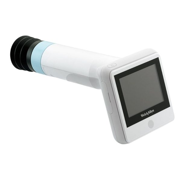 RetinaVue 100 Imager Non-Mydriatic Retinal Camera - Image 4